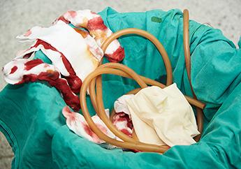 Blood-covered gauze, latex gloves, rubber tubing and other surgical waste in a waste can in an operating room